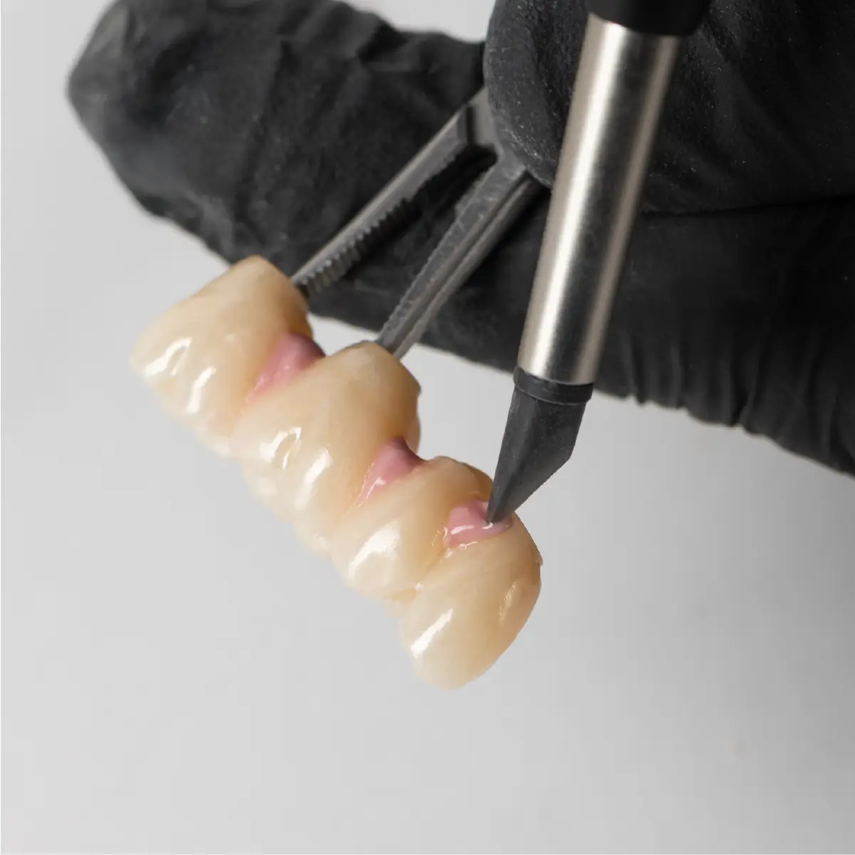 exemplu de utilizare a varfului de silicon pentru evidentierea gingiei in laboratorul de tehnica dentara