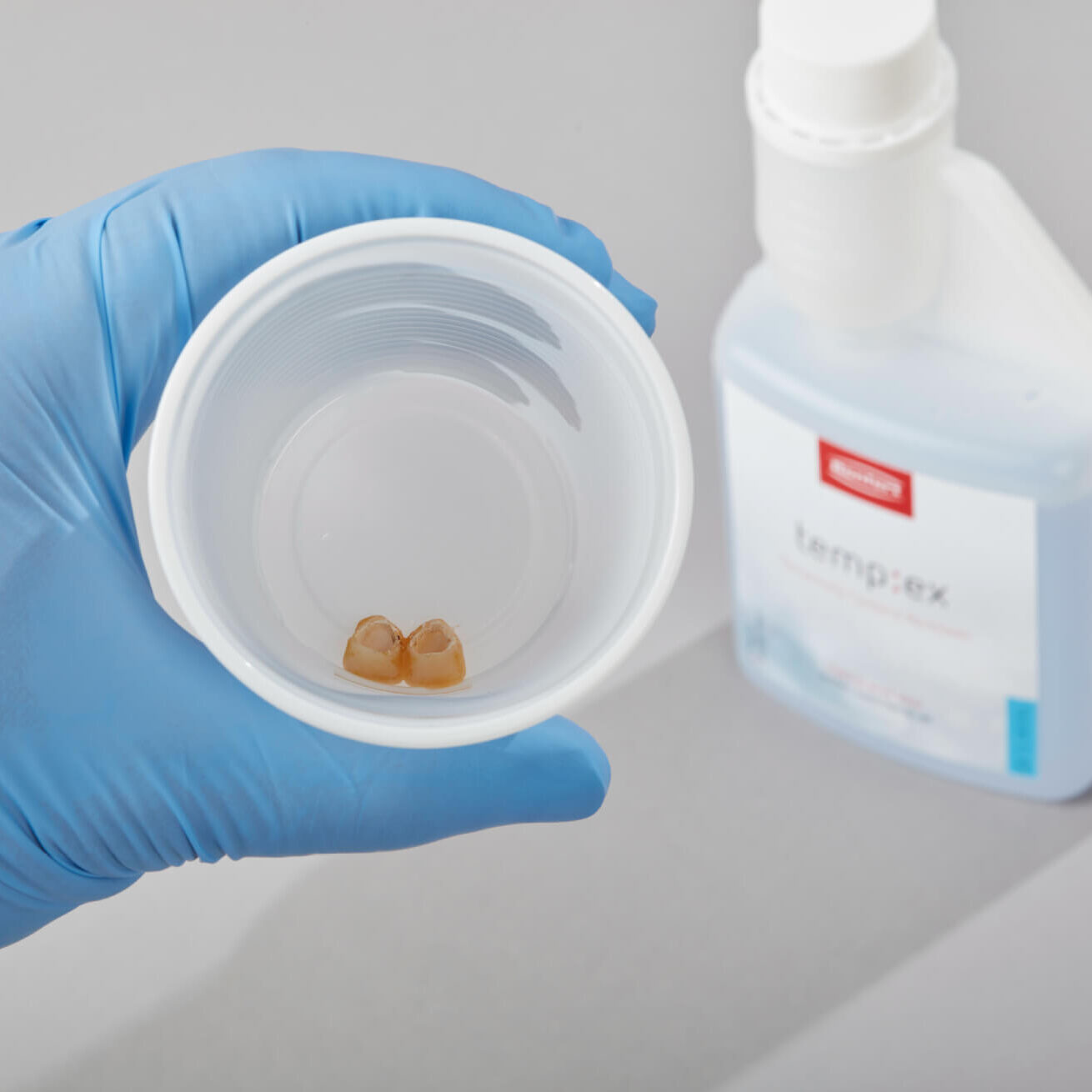 lucrare pusa intr-un pahar pentru a fi curatata cu solutia de curatare a cimentului temporar renfert