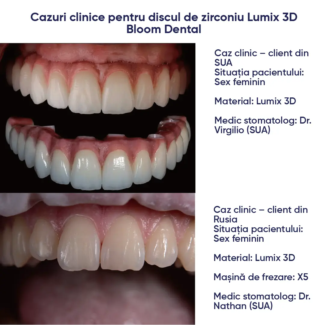cazuri clinice in care s-a utilizat discul de zirconiu Ultra 3D PRO ML lumix