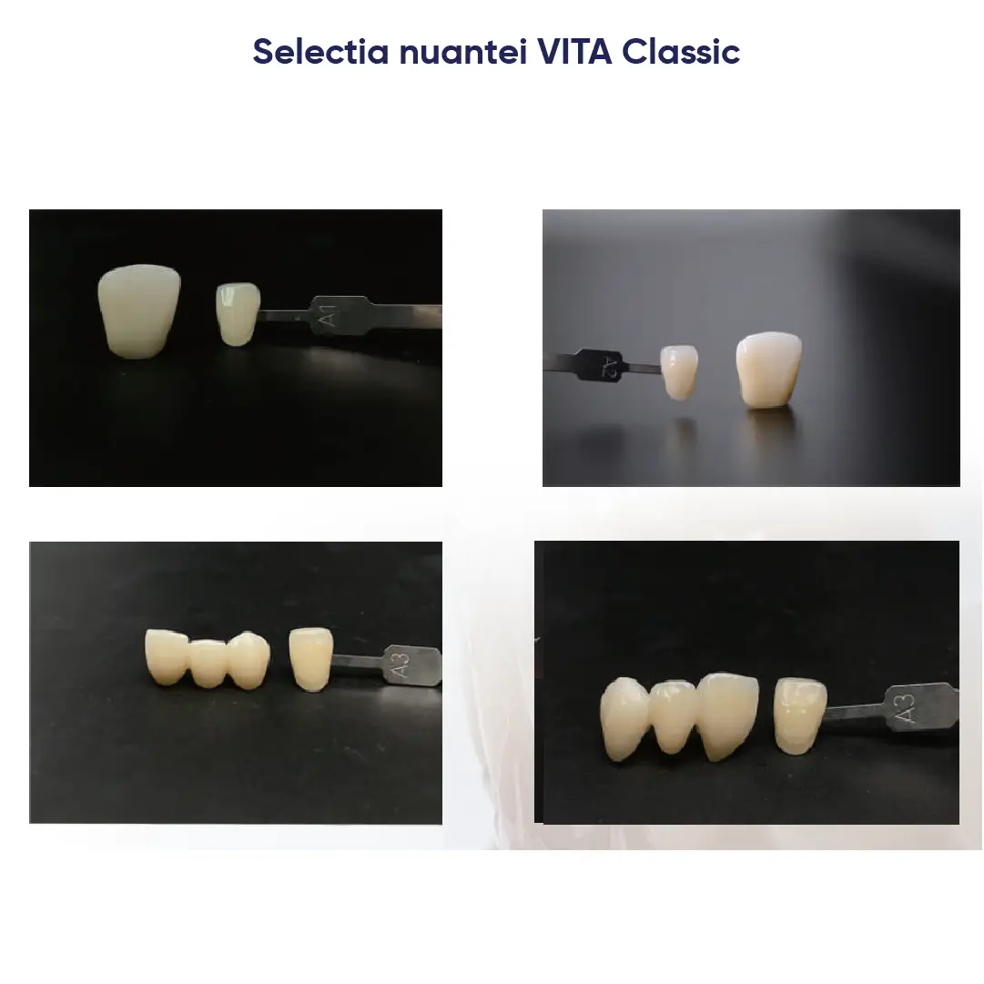 selectia nuantei pentru discul de zirconiu ultra 3D pro ML