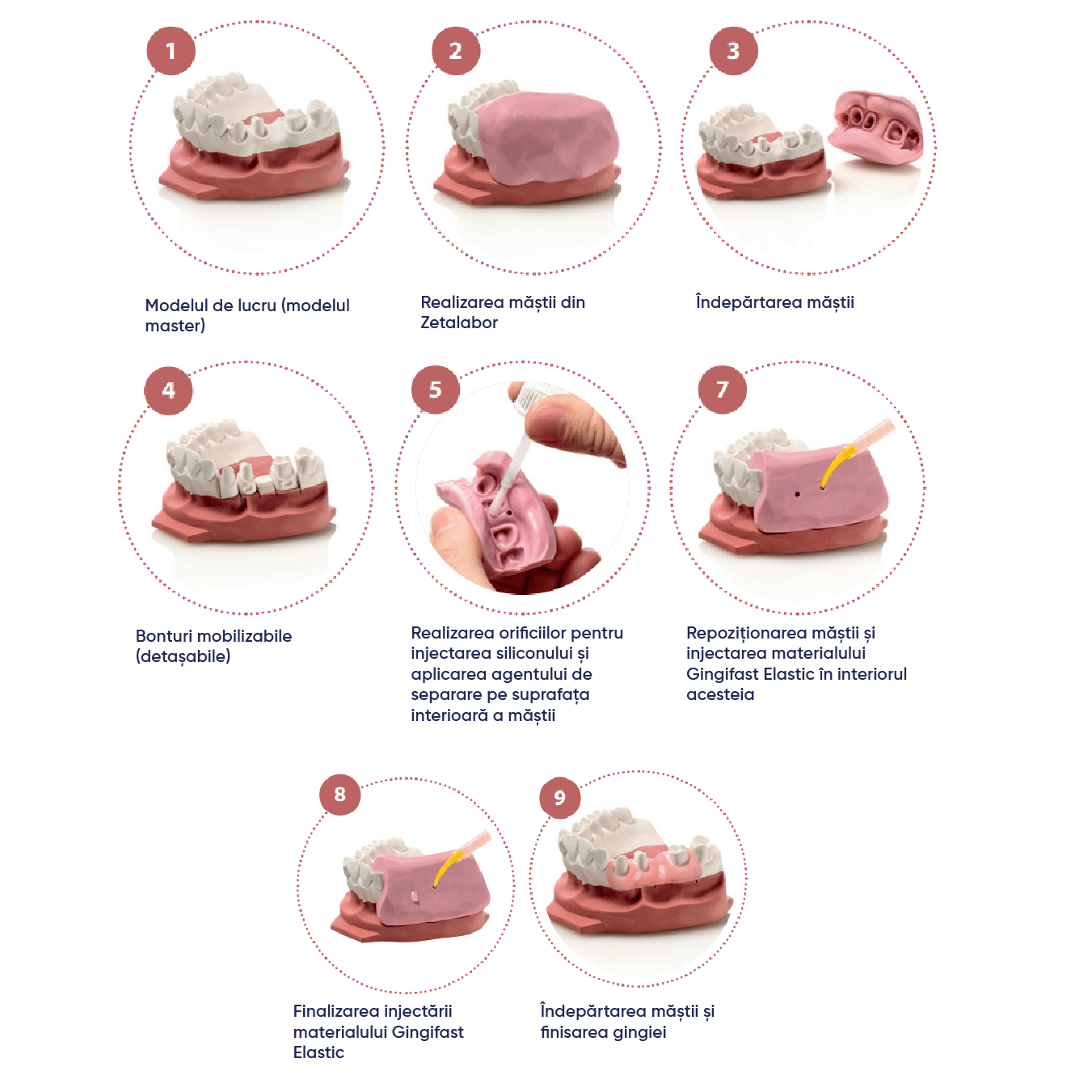 pasi de utilizare silicon de aditie gingifast elastic cu lucrare realizata