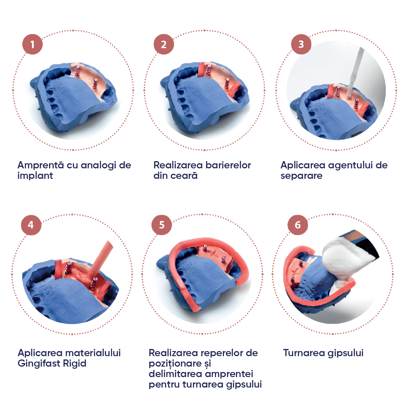 pasi de utilizare silicon de aditie gingifast rigid cu lucrare realizata