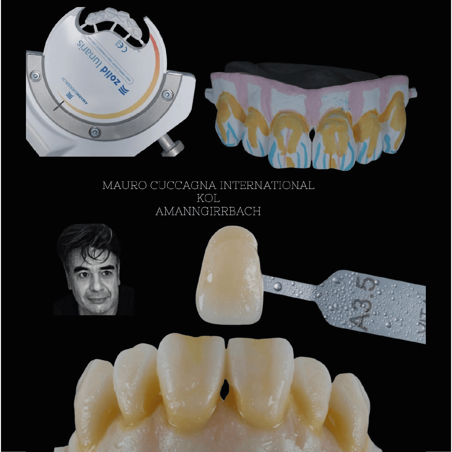 exemplu de utilizare si de culoare pentru discul de zirconiu multilayer zolid lunaris